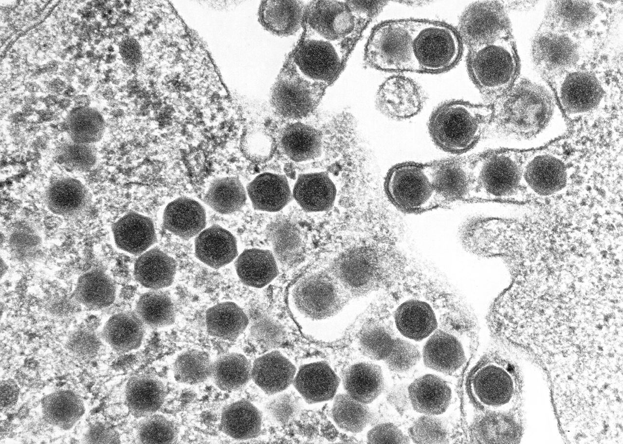 A microscopic image of ranavirus.